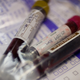 Image for article titled Rumors, Concern Continue To Swirl In Porn Valley After Positive HIV Test